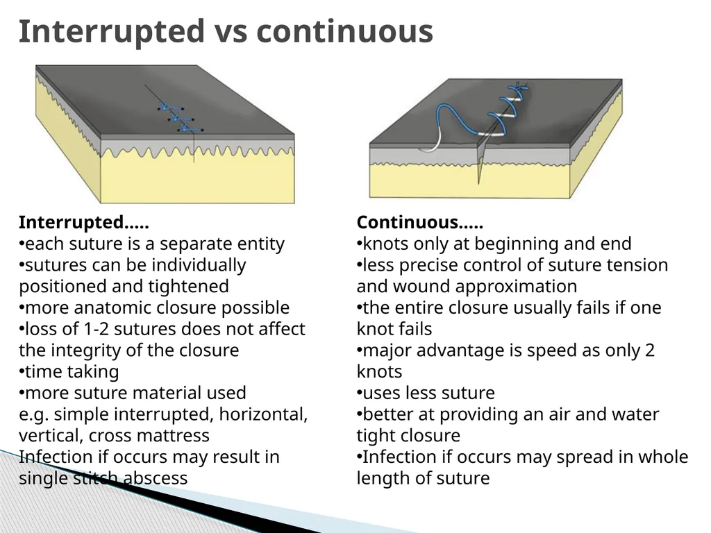 SUTURE – MATERIALS & METHODS Dr. Rudra Pratap - slide 39 of 45