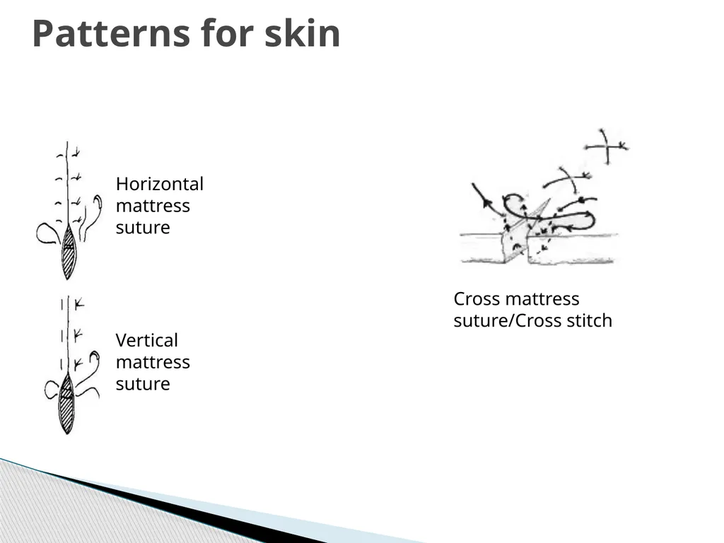 SUTURE – MATERIALS & METHODS Dr. Rudra Pratap - slide 42 of 45