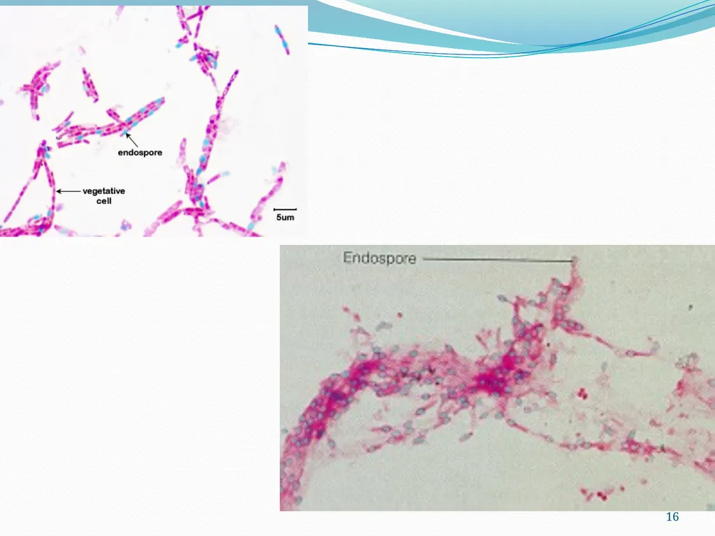 Bacterial Spores (endospore) 1- This machine named - slide 16 of 19