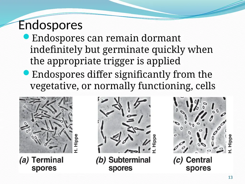 Bacterial Spores (endospore) 1- This machine named - slide 13 of 19