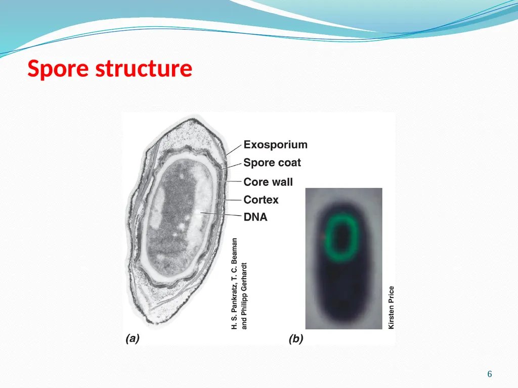 Bacterial Spores (endospore) 1- This machine named - slide 6 of 19