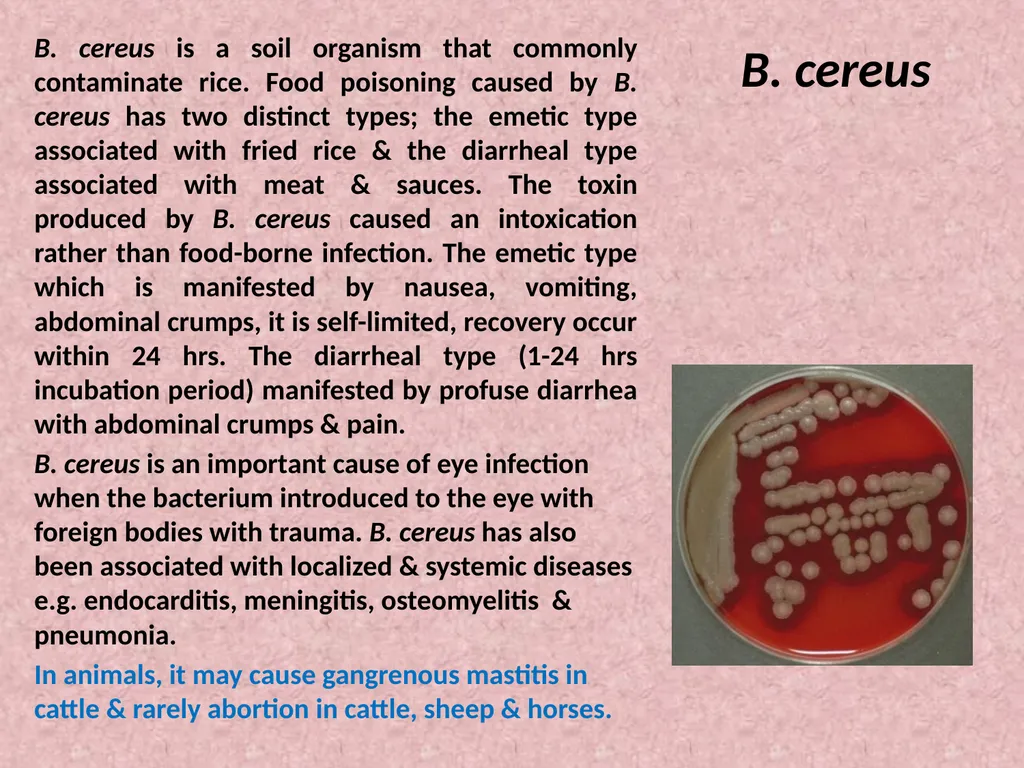 Spore-forming G positive bacilli - Aerobic - slide 2 of 15