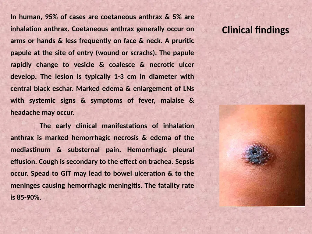 Spore-forming G positive bacilli - Aerobic - slide 7 of 15