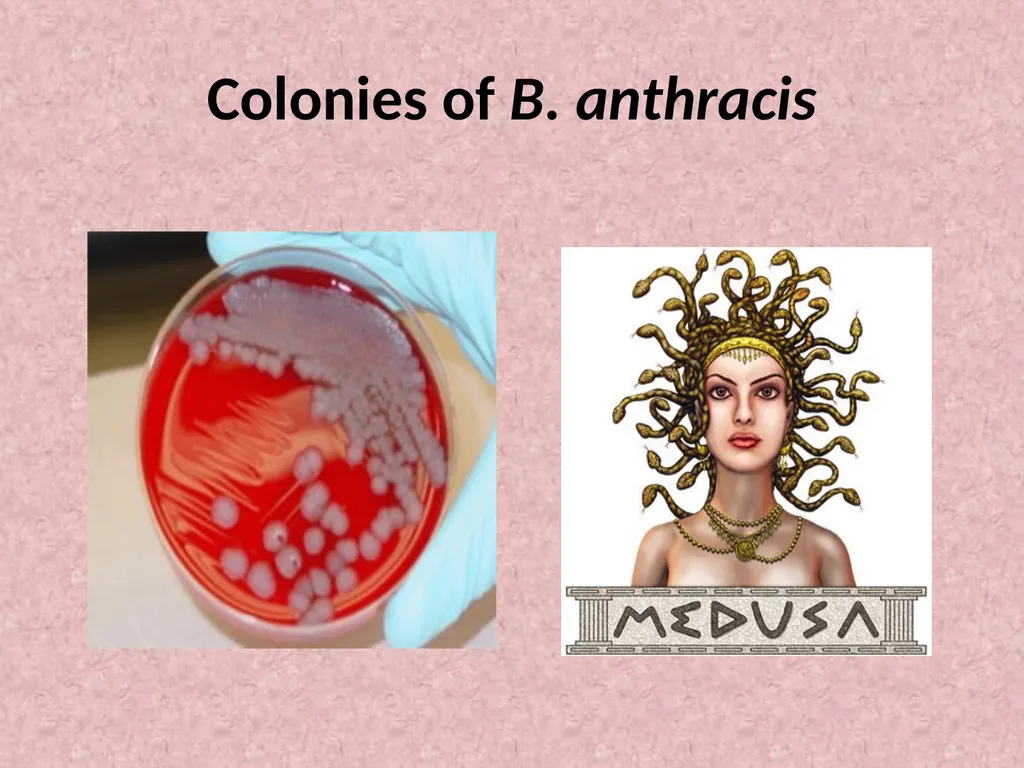 Spore-forming G positive bacilli - Aerobic - slide 4 of 15