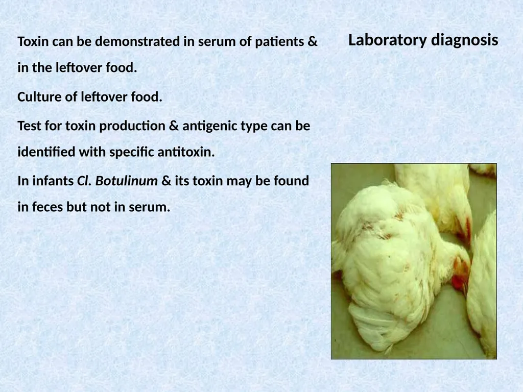 Spore-forming G positive bacilli - Aerobic - slide 15 of 15