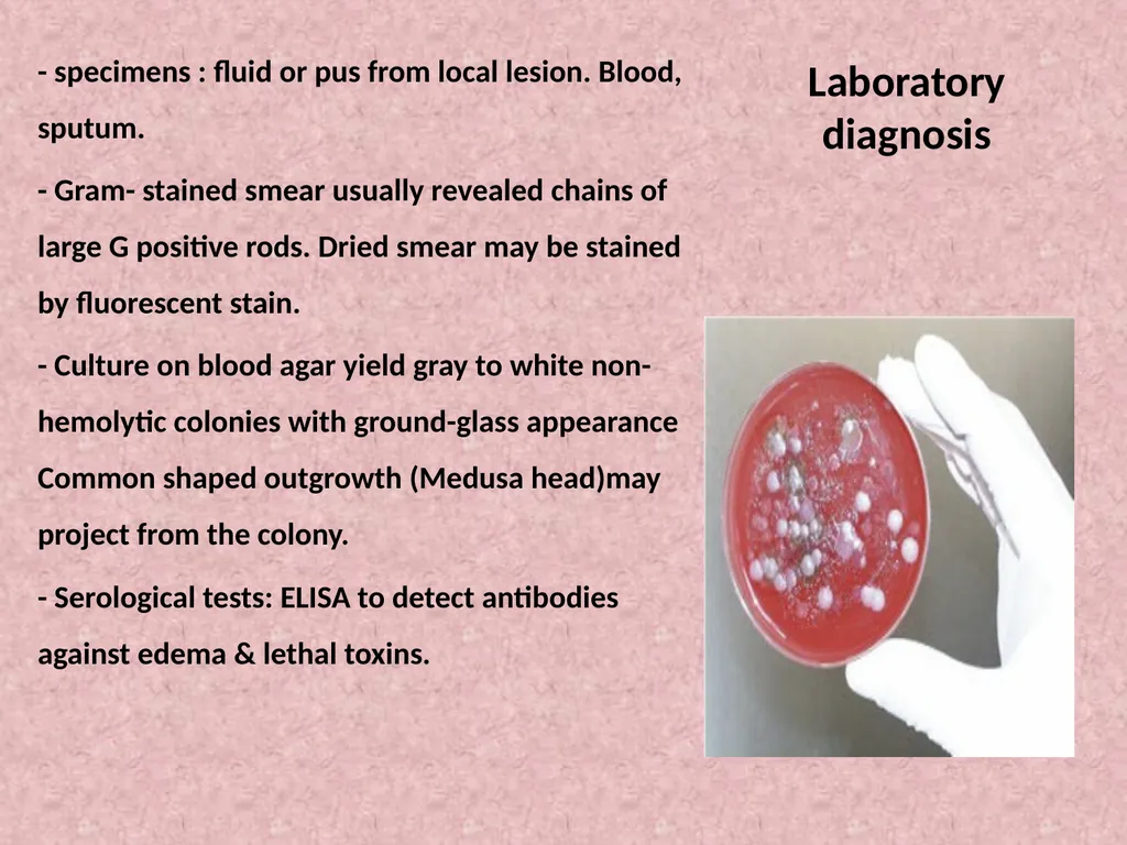 Spore-forming G positive bacilli - Aerobic - slide 9 of 15