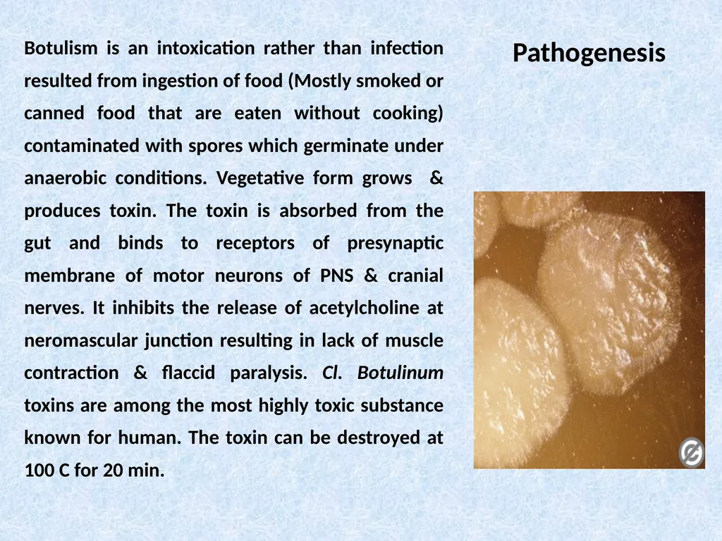 Spore-forming G positive bacilli - Aerobic - slide 13 of 15