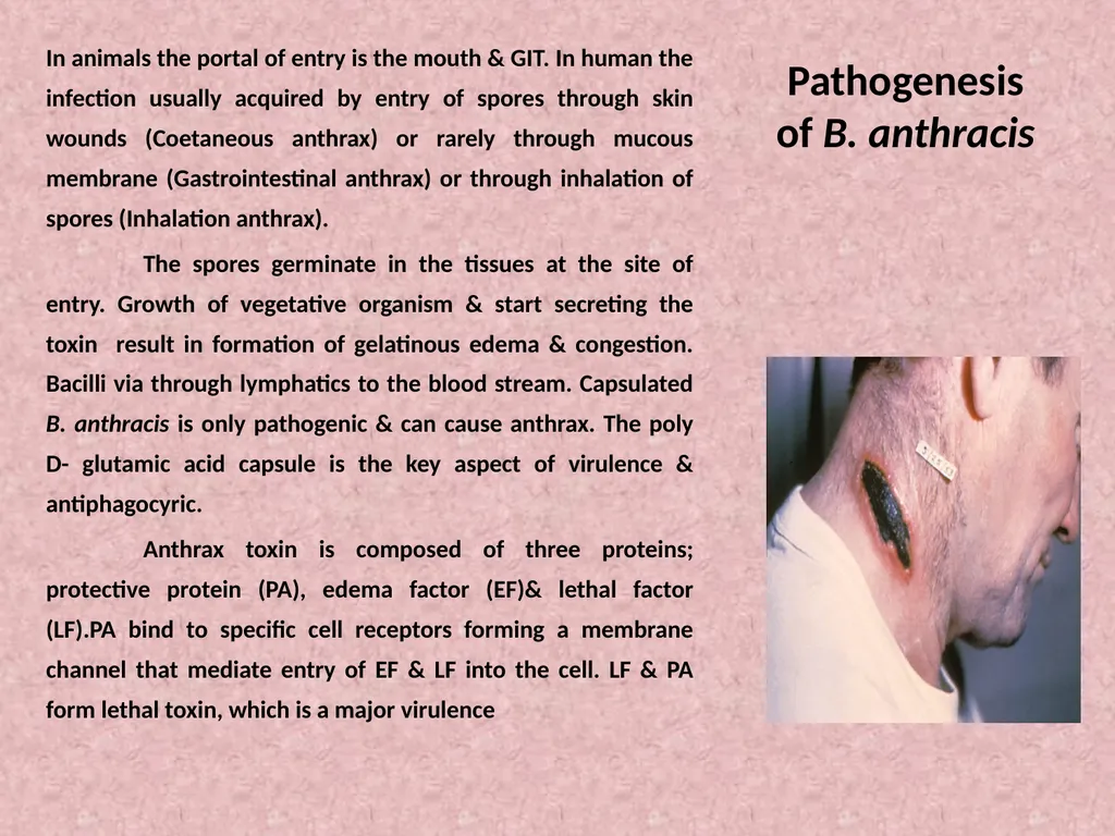 Spore-forming G positive bacilli - Aerobic - slide 5 of 15