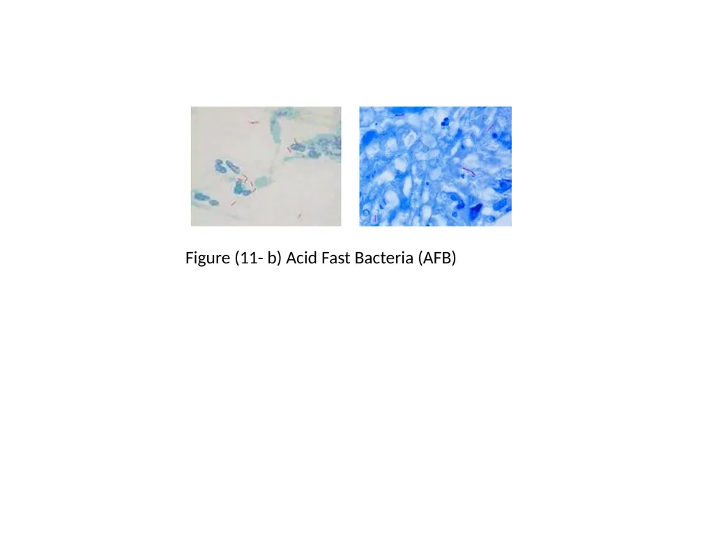 Spore Stain: Spores represent a chemically and - slide 5 of 6