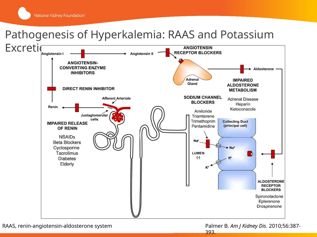 Evaluation and Management of Hyperkalemia This - slide 8 of 35
