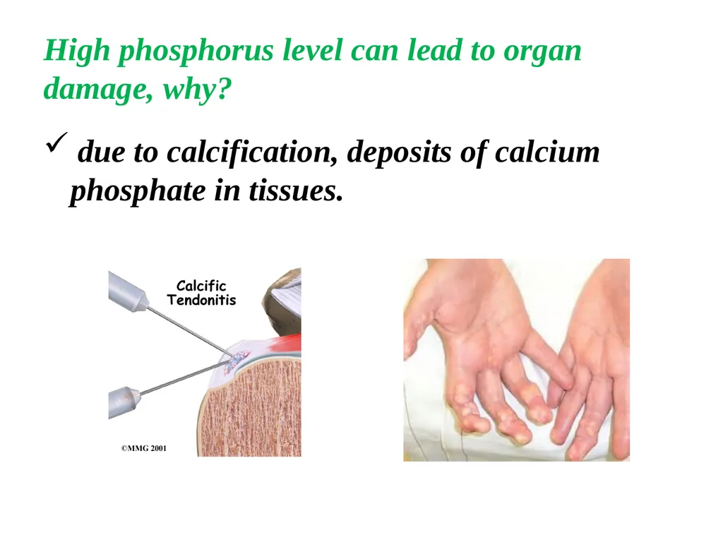 Blood Phosphorus Presented By Assist.Lecturer - slide 8 of 10