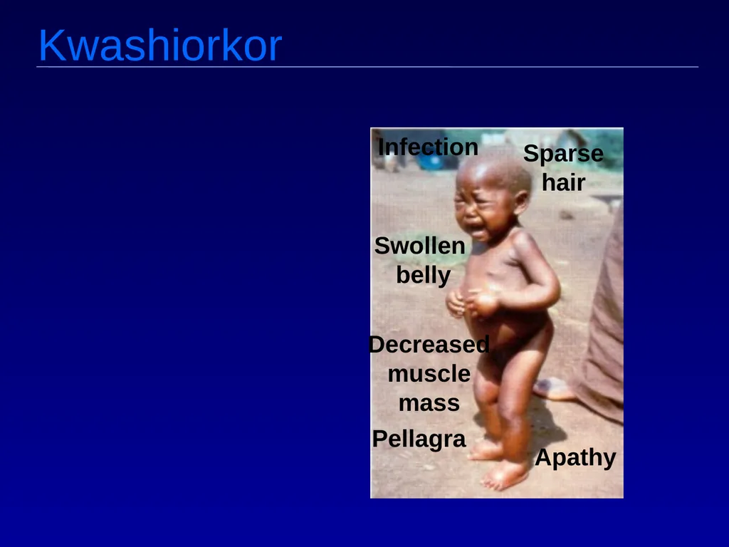 Macro v. micro nutrients Macro-nutrients Protein - slide 16 of 25