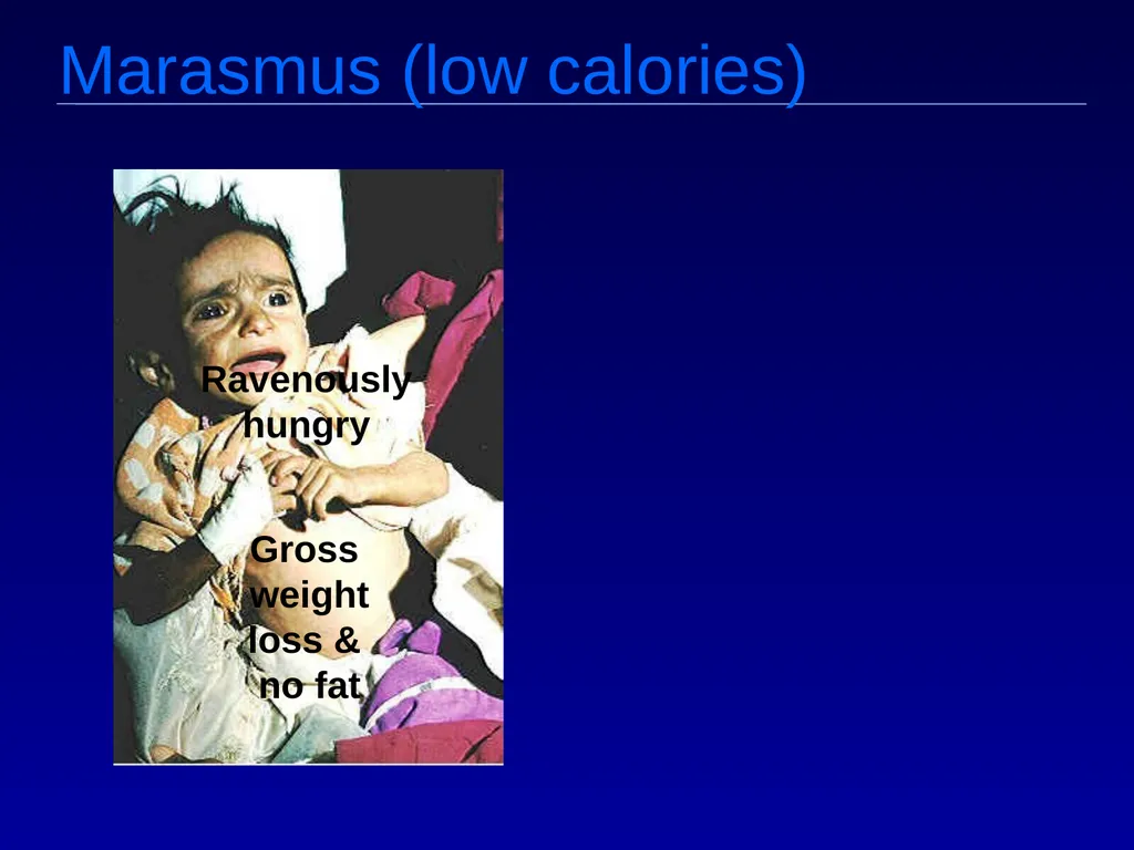 Macro v. micro nutrients Macro-nutrients Protein - slide 19 of 25