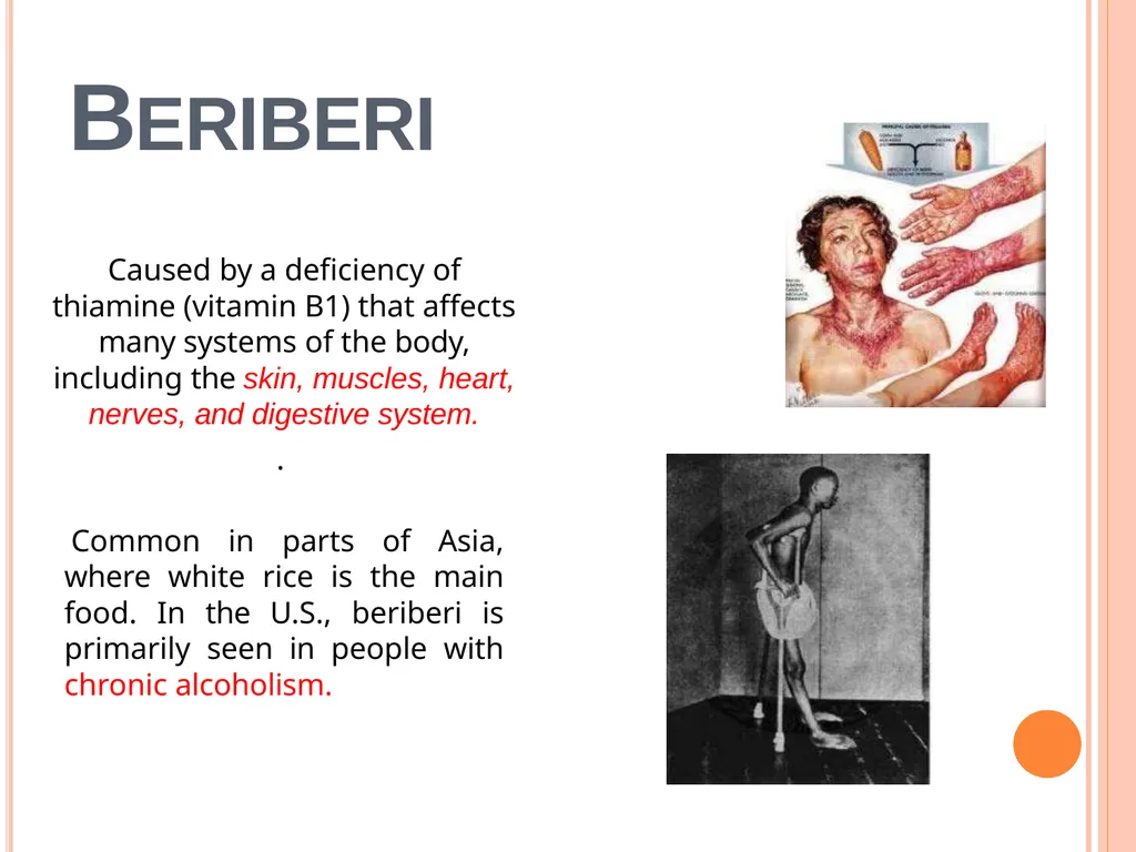 Balanced Diet and Nutrients What is balanced - slide 35 of 52
