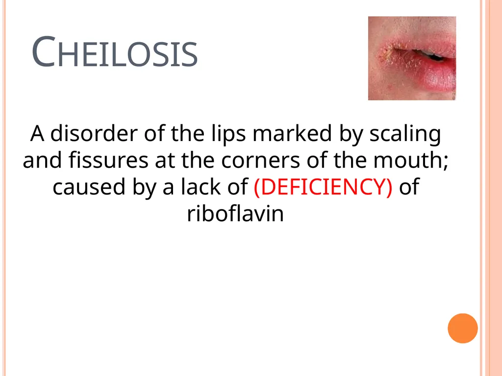 Balanced Diet and Nutrients What is balanced - slide 37 of 52