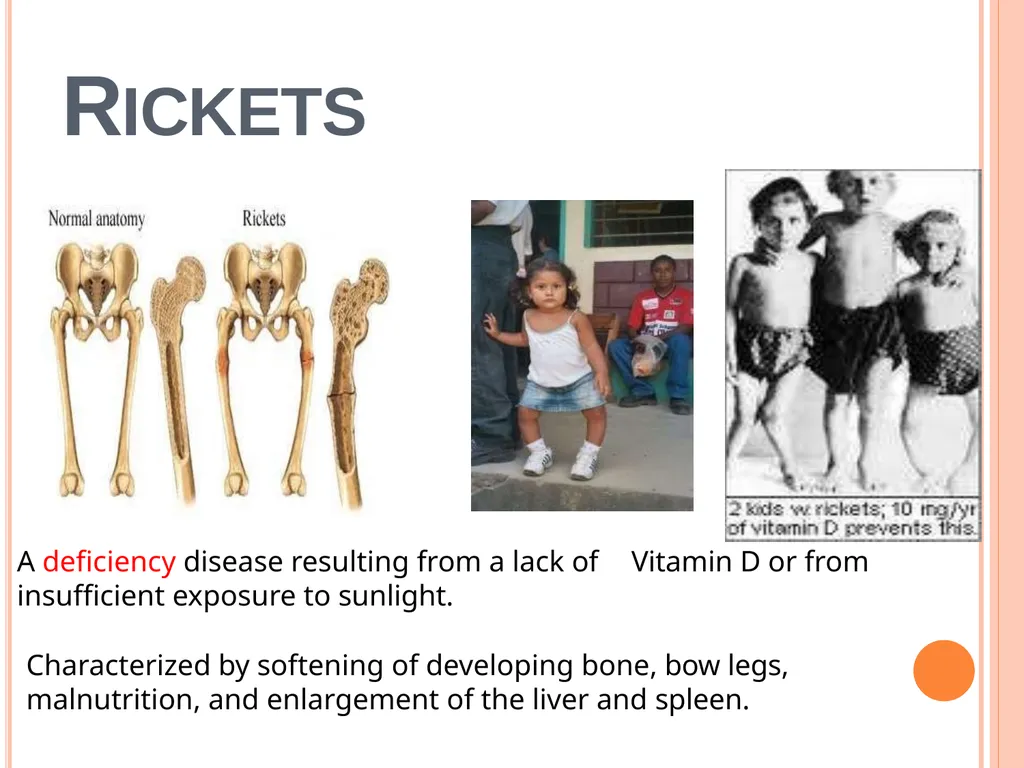 Balanced Diet and Nutrients What is balanced - slide 27 of 52