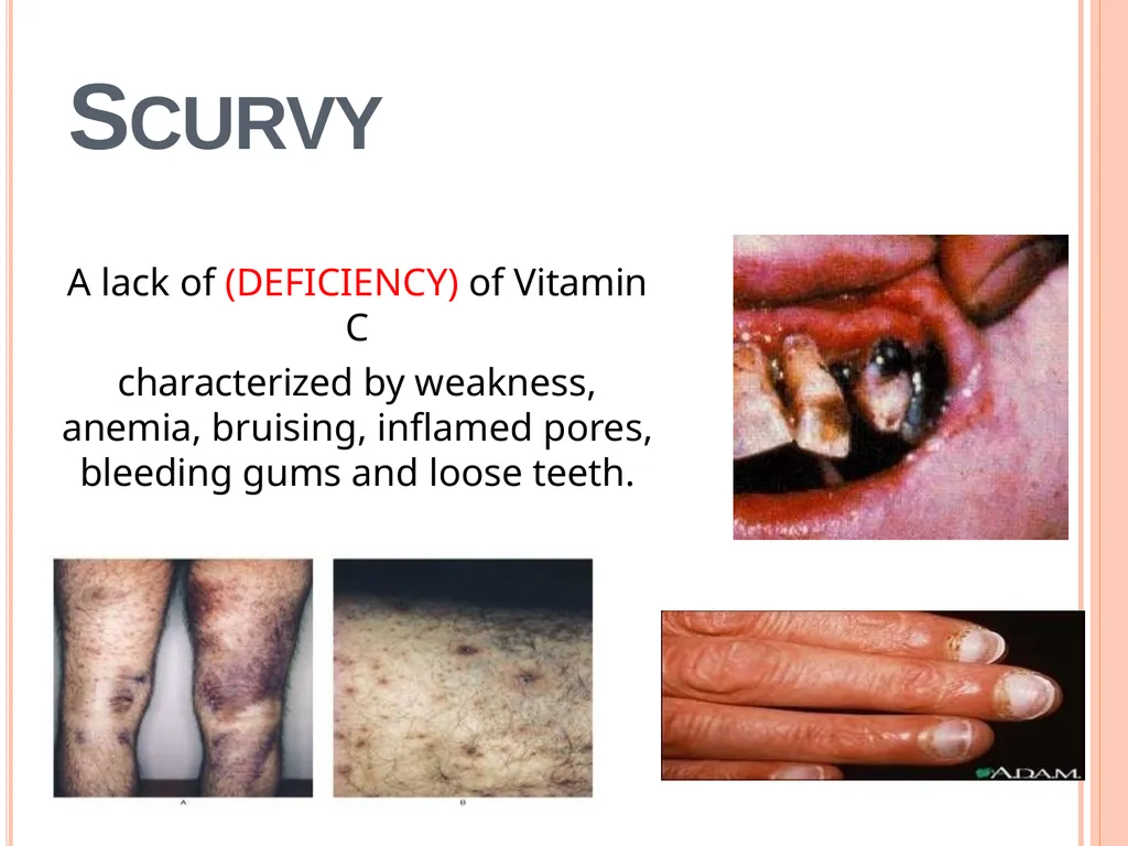 Balanced Diet and Nutrients What is balanced - slide 32 of 52
