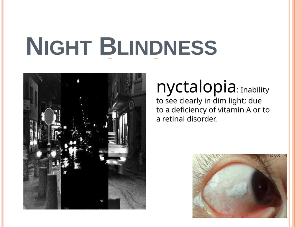 Balanced Diet and Nutrients What is balanced - slide 25 of 52