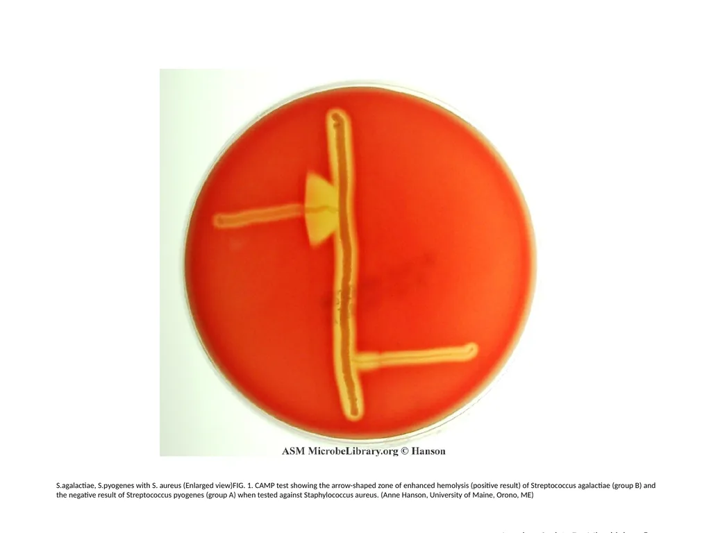 S.agalactiae, S.pyogenes with S. aureus (Enlarged - slide 1 of 7