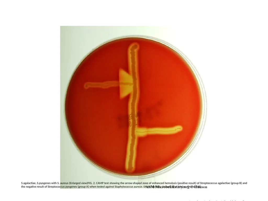 S.agalactiae, S.pyogenes with S. aureus (Enlarged - slide 2 of 7