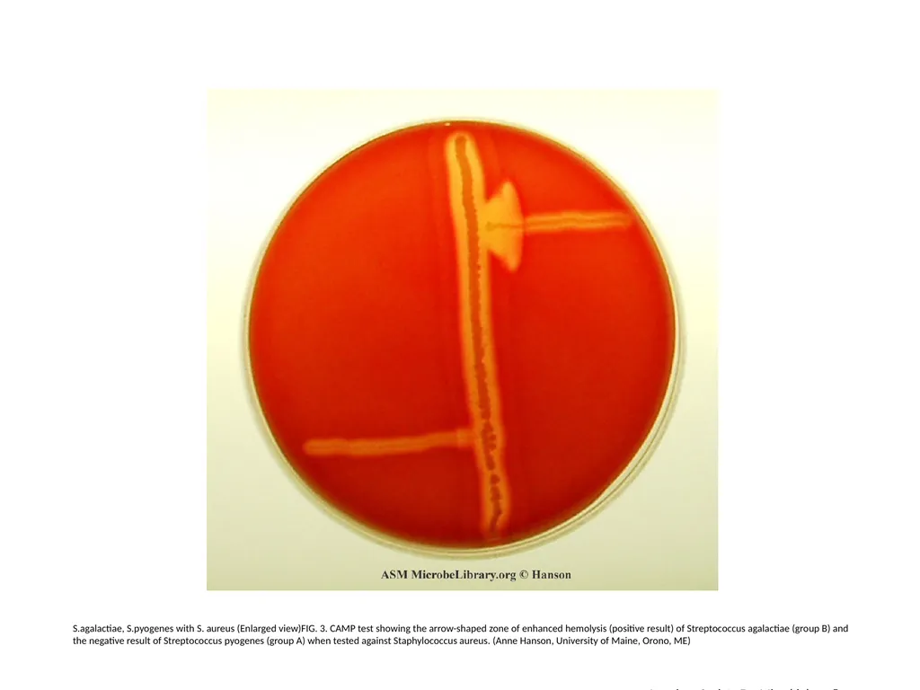 S.agalactiae, S.pyogenes with S. aureus (Enlarged - slide 3 of 7