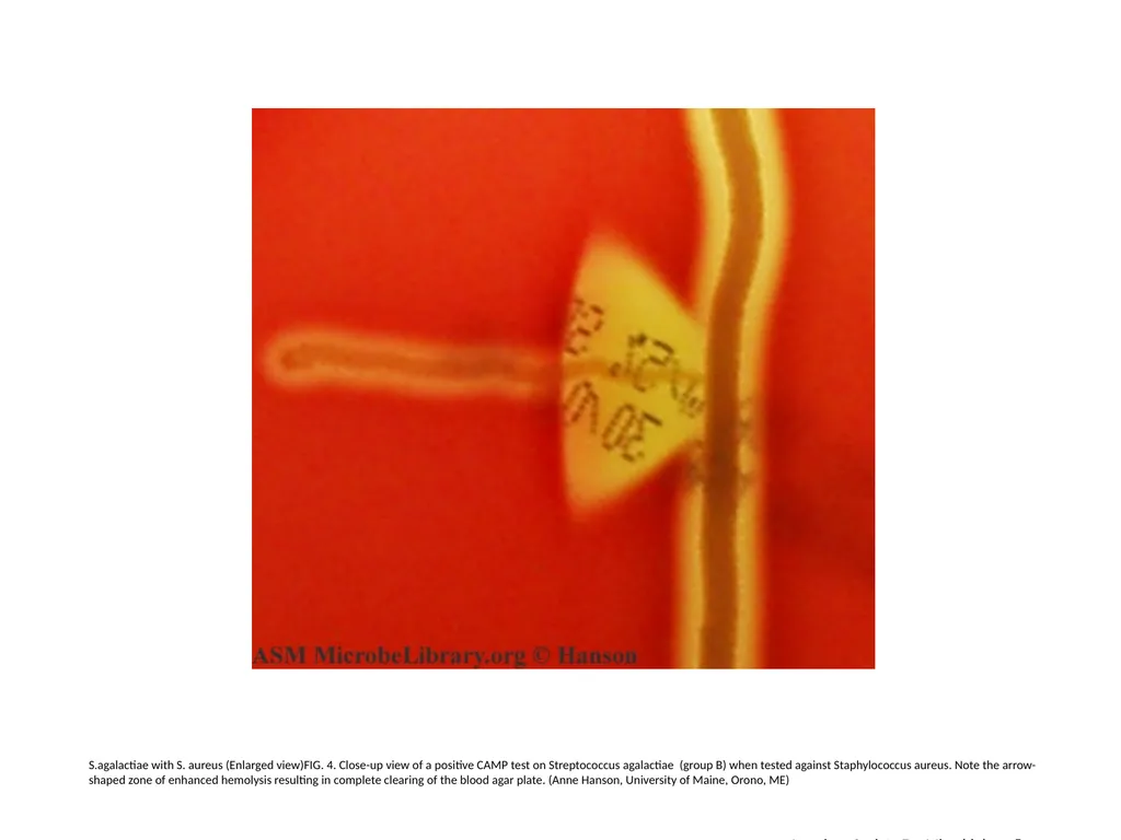 S.agalactiae, S.pyogenes with S. aureus (Enlarged - slide 4 of 7