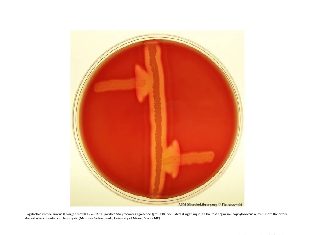 S.agalactiae, S.pyogenes with S. aureus (Enlarged - slide 6 of 7