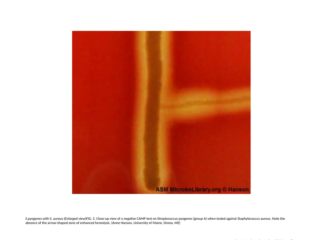 S.agalactiae, S.pyogenes with S. aureus (Enlarged - slide 5 of 7