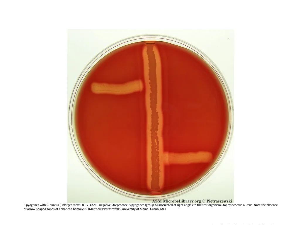 S.agalactiae, S.pyogenes with S. aureus (Enlarged - slide 7 of 7
