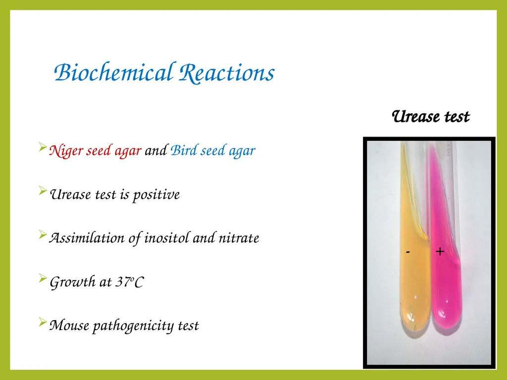 Cryptococcal meningitis Dr. Priyanka Chaturvedi - slide 18 of 30