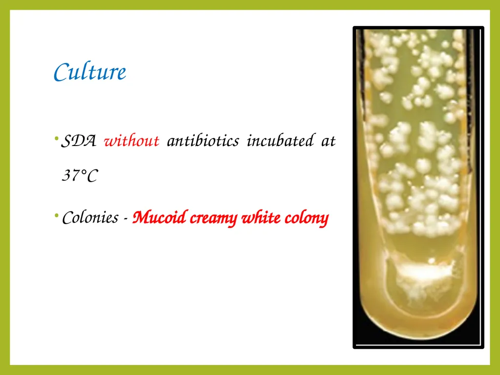 Cryptococcal meningitis Dr. Priyanka Chaturvedi - slide 17 of 30