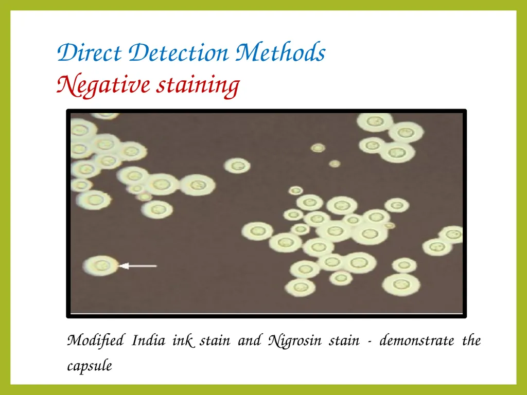 Cryptococcal meningitis Dr. Priyanka Chaturvedi - slide 15 of 30