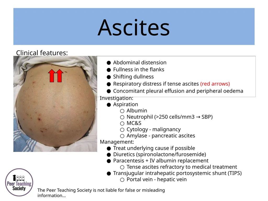HEPATOLOGY Phase 2a Revision Session Rye Yap & May - slide 30 of 38