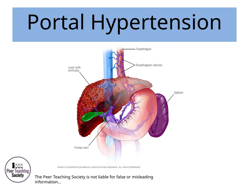 HEPATOLOGY Phase 2a Revision Session Rye Yap & May - slide 27 of 38