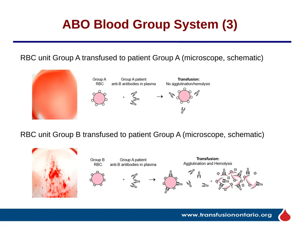 The Elephant in the Transfusionist’s Skill Set: - slide 14 of 44