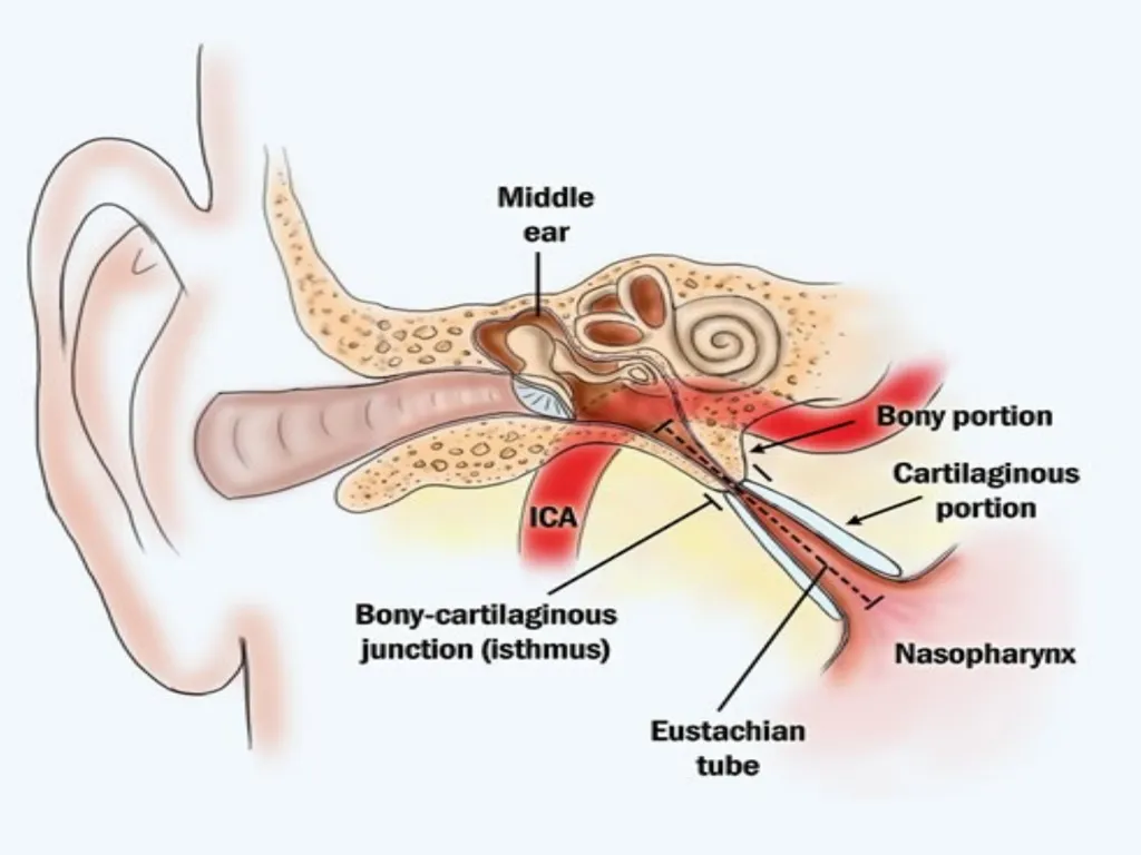 Upper Respiratory System Disorder Lecturer - slide 15 of 26