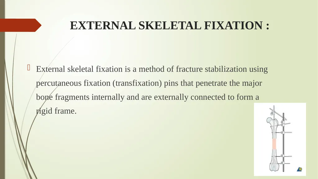 Techniques of external fracture fixation . Dr. - slide 11 of 22