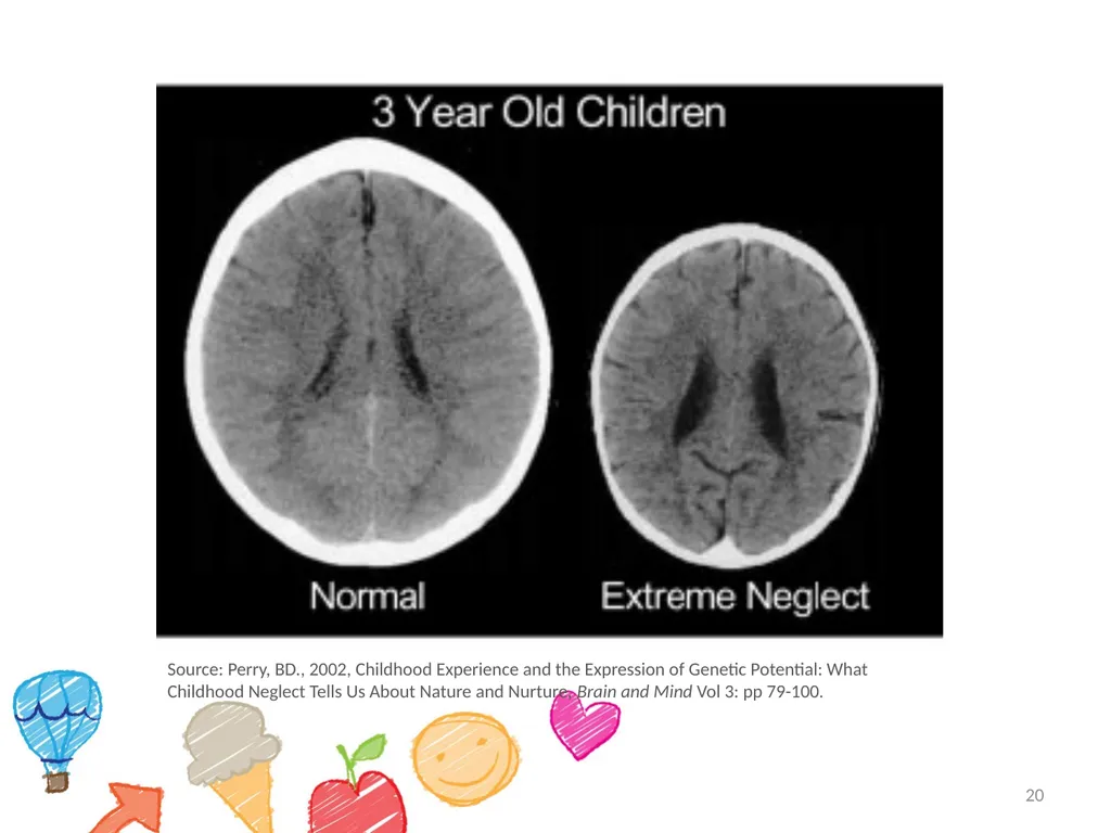 Module 1 – young children and trauma What is - slide 20 of 51