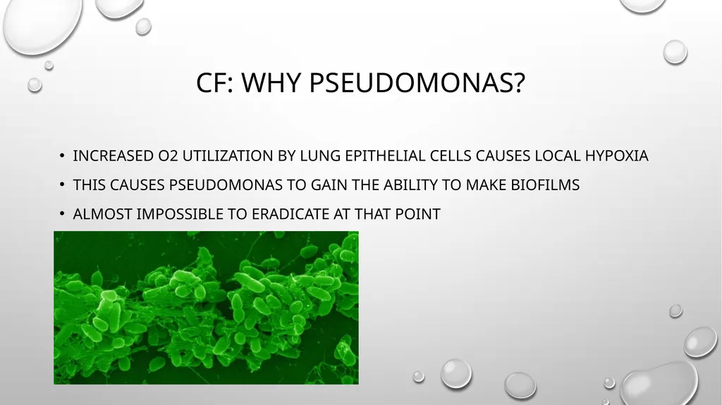 Obstructive and restrictive Lung Disease Jed - slide 29 of 36