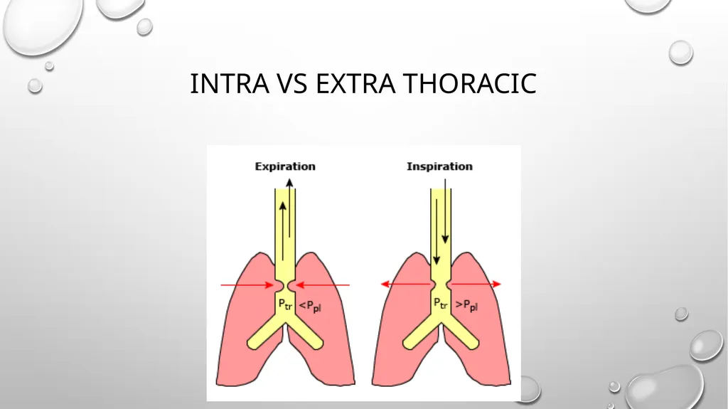 Obstructive and restrictive Lung Disease Jed - slide 7 of 36