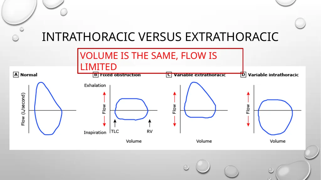 Obstructive and restrictive Lung Disease Jed - slide 11 of 36