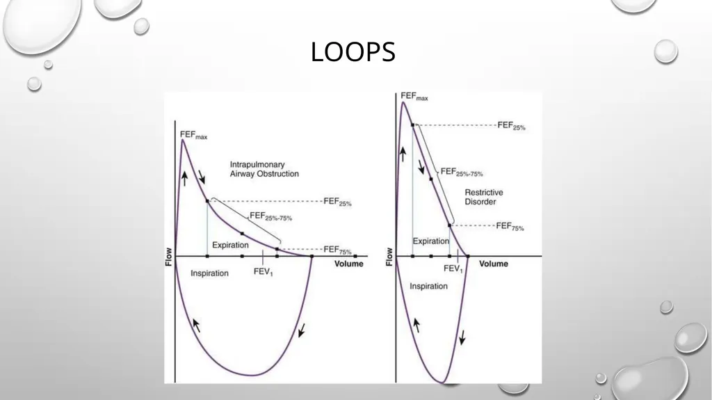 Obstructive and restrictive Lung Disease Jed - slide 20 of 36