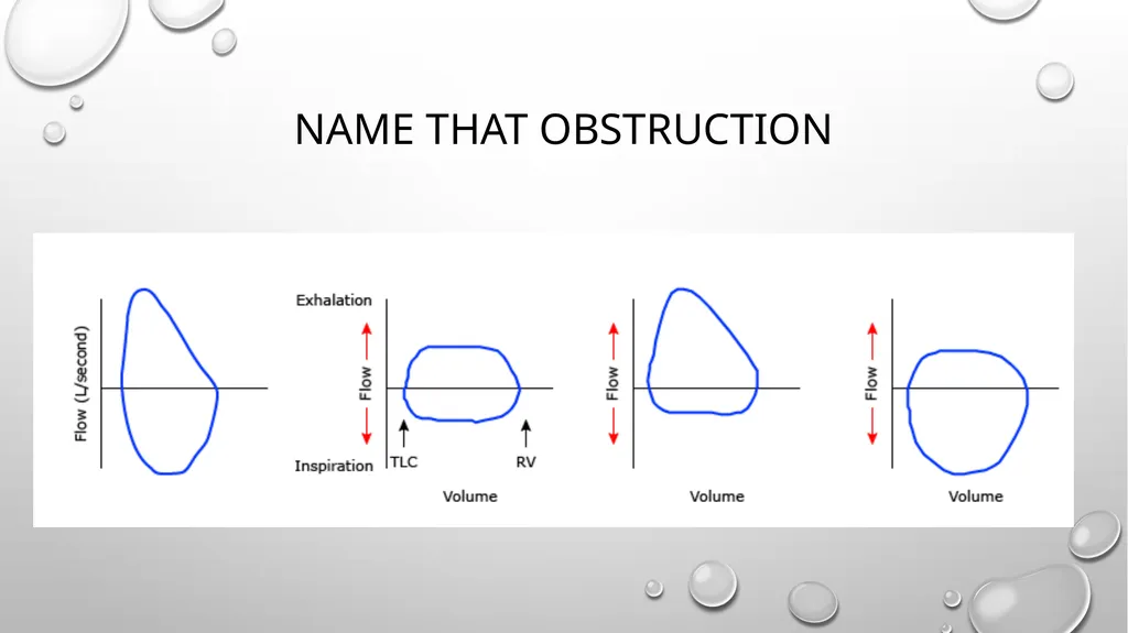 Obstructive and restrictive Lung Disease Jed - slide 10 of 36