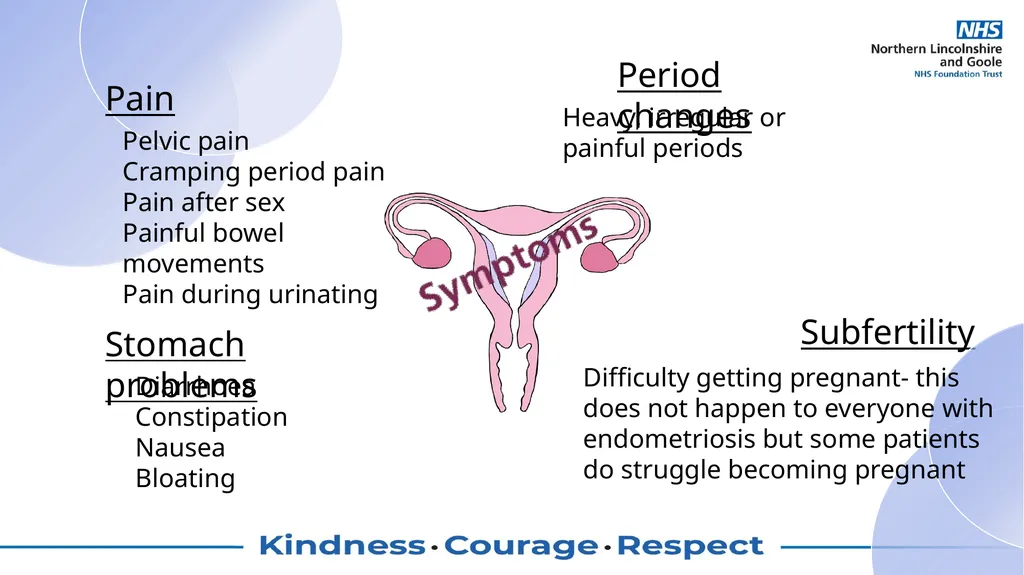 Symptoms in endometriosis and what causes them? - slide 3 of 6