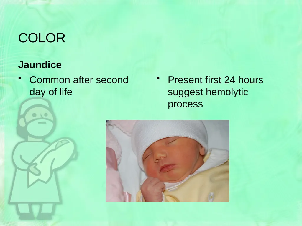 Newborn Assessment Jan Mould, RN, BSN, MEd HOSA – - slide 15 of 25