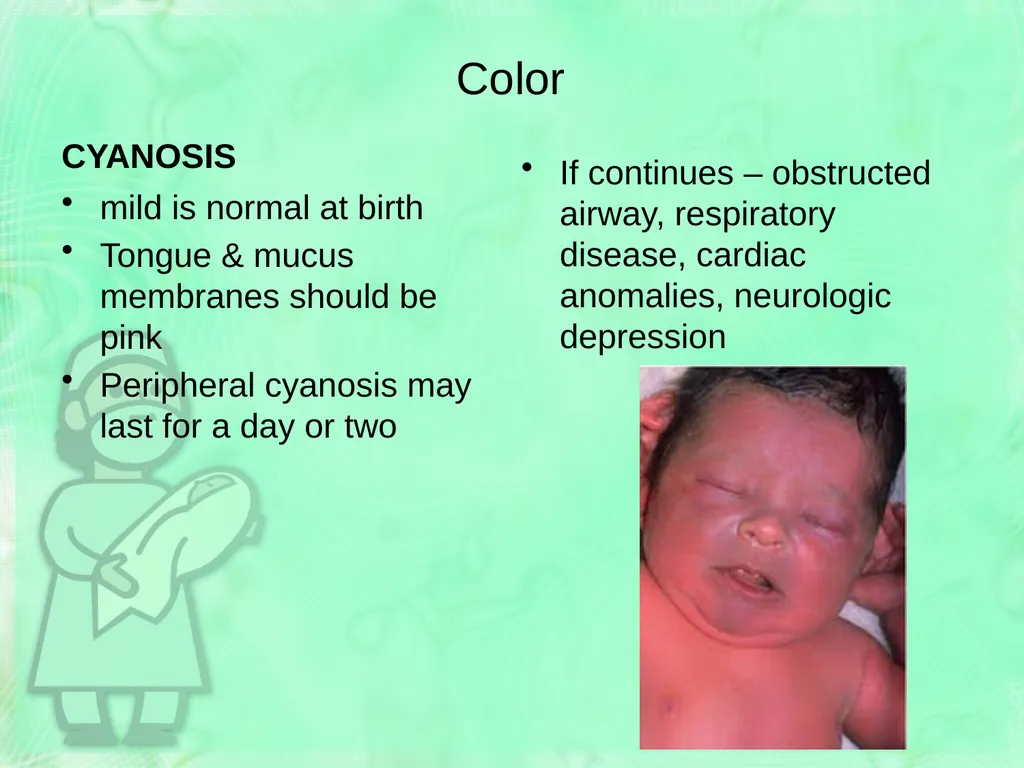 Newborn Assessment Jan Mould, RN, BSN, MEd HOSA – - slide 14 of 25