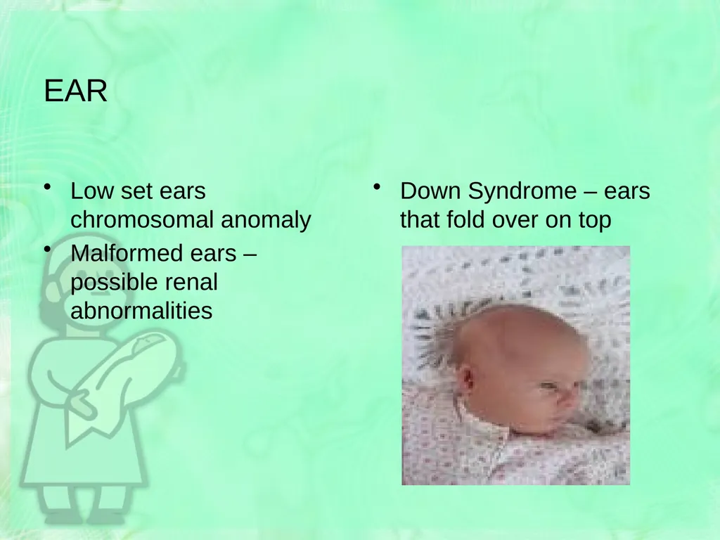 Newborn Assessment Jan Mould, RN, BSN, MEd HOSA – - slide 19 of 25