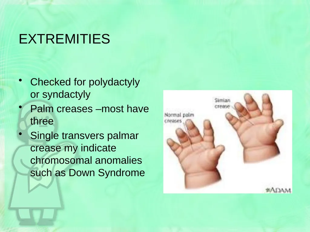 Newborn Assessment Jan Mould, RN, BSN, MEd HOSA – - slide 25 of 25