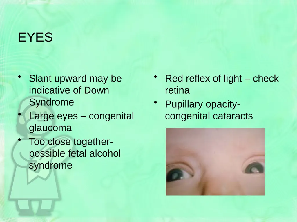 Newborn Assessment Jan Mould, RN, BSN, MEd HOSA – - slide 18 of 25