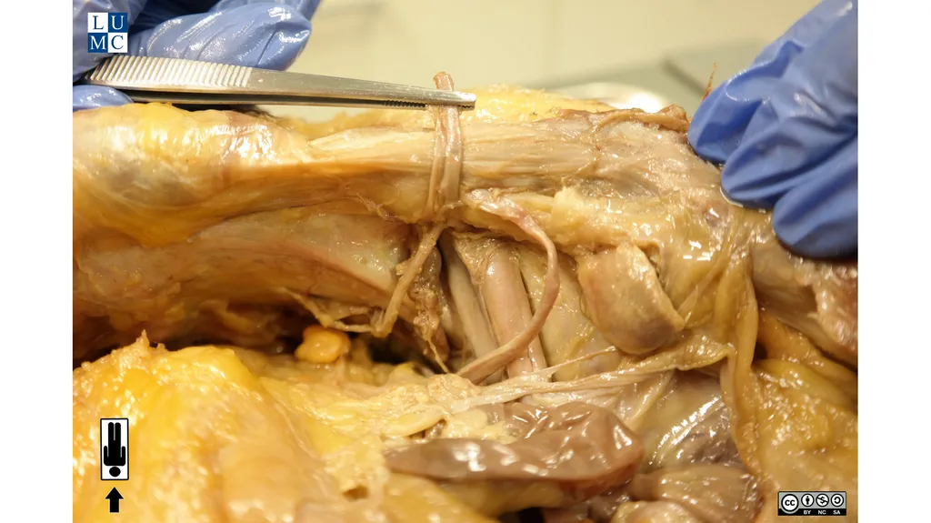 Leiden - Photo Internal view female inguinal - slide 3 of 3
